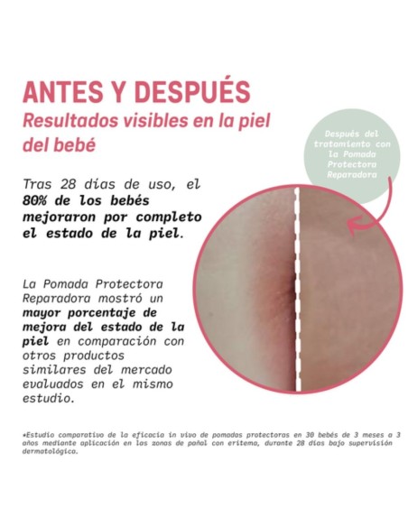 Pomada Protectora Reparadora de Pañal 100ml Suavinex